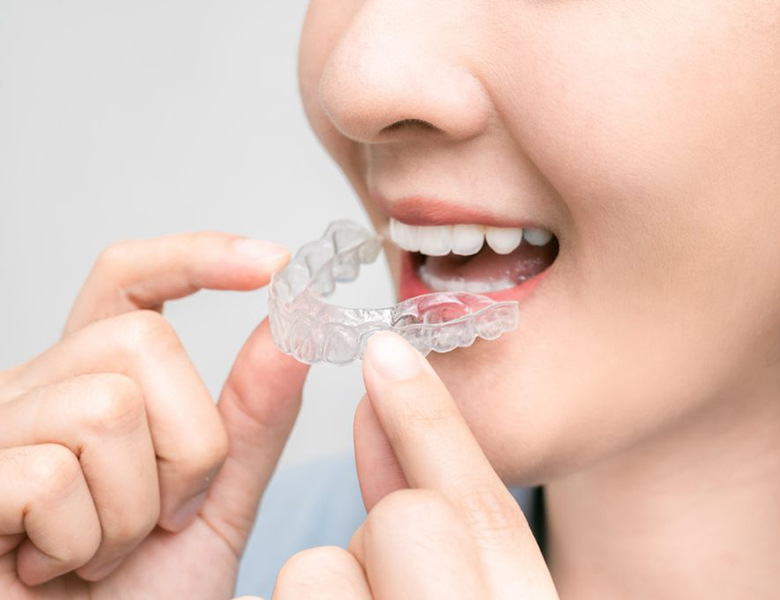 八千代緑が丘駅より徒歩1分の歯医者、公園都市プラザわかば歯科の矯正歯科