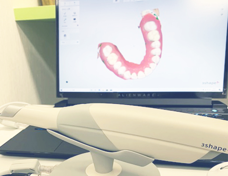 八千代緑が丘駅より徒歩1分の歯医者、公園都市プラザわかば歯科のＴＲＩＯＳ３