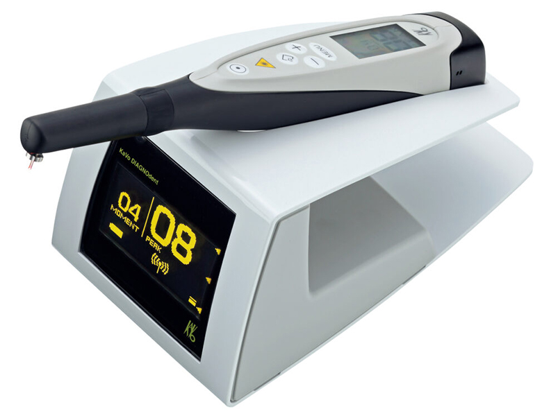 八千代緑が丘駅より徒歩1分の歯医者、公園都市プラザわかば歯科のなるべく削らず、歯を守る治療