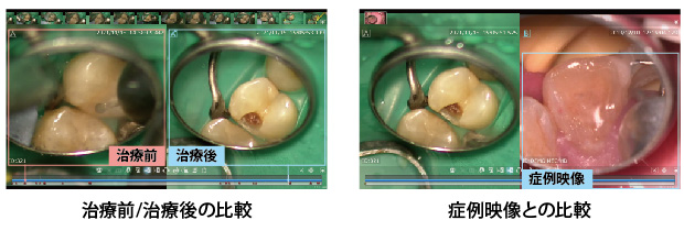 千葉県茂原市の歯医者、たけ歯科クリニックのマイクロスコープ精密治療