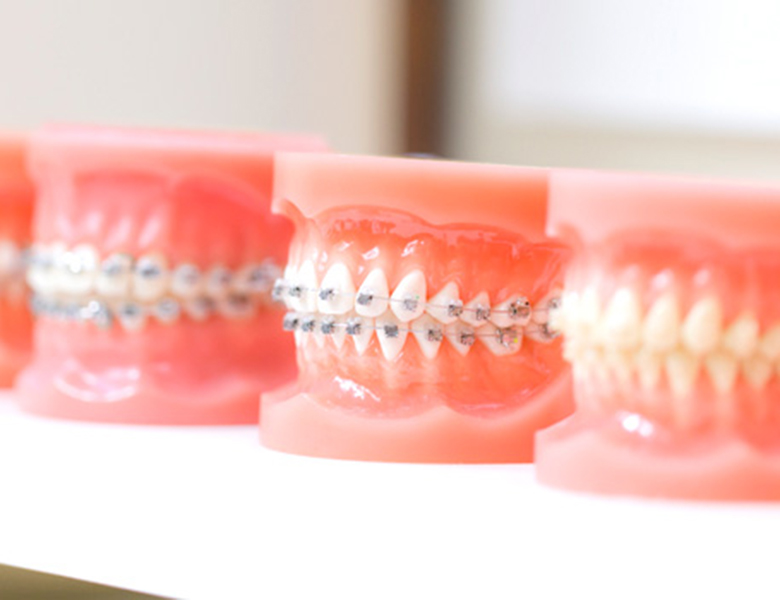 八千代緑が丘駅より徒歩1分の歯医者、公園都市プラザわかば歯科の矯正歯科