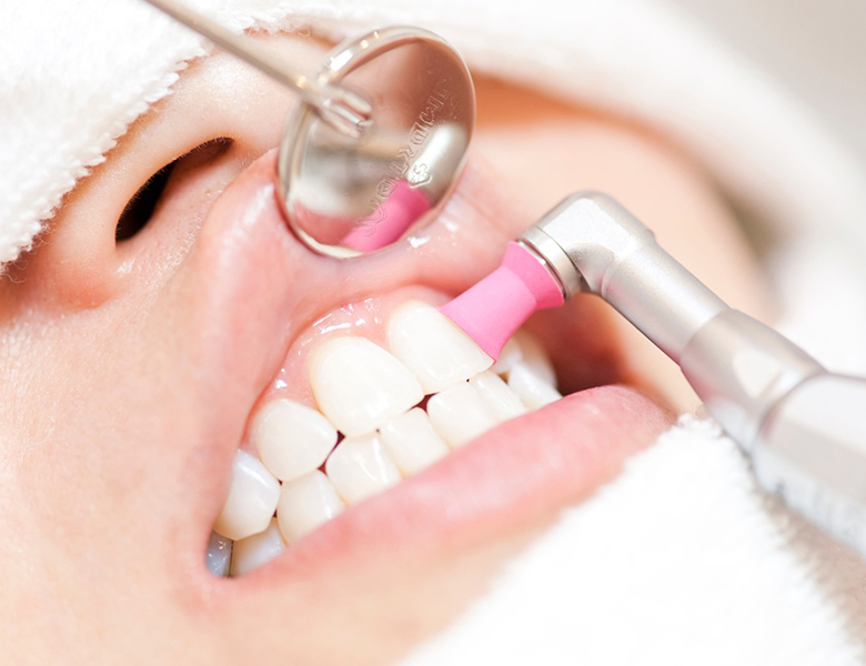 千葉県茂原市の歯医者、たけ歯科クリニックの予防歯科